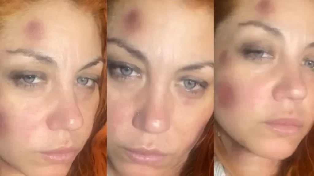 lourdes bandana violencia genero