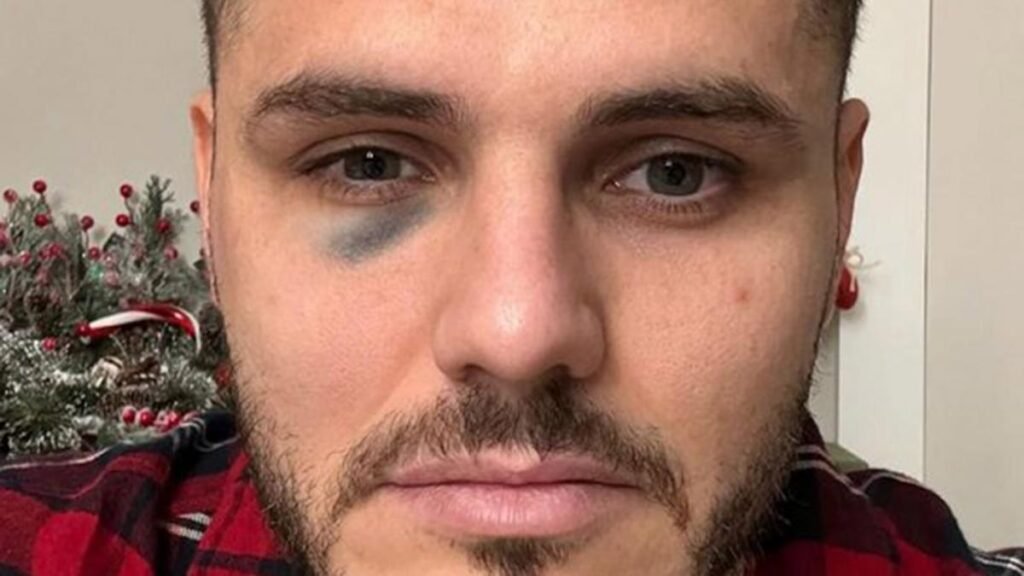 icardi