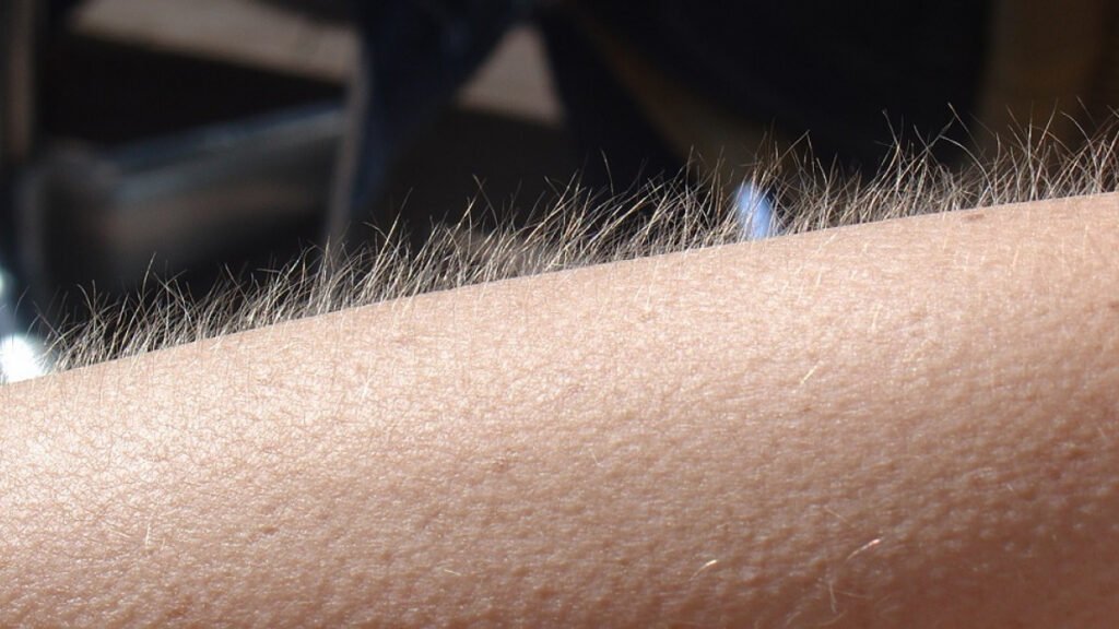 Qué es y cómo se forma la piel de gallina por que piel de gallina wide