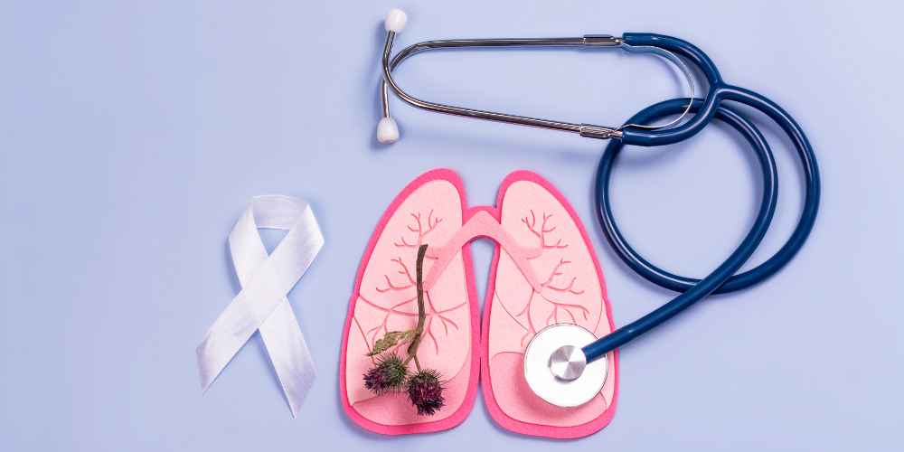 “No te quedes en el banco”, la campaña que impulsa la detección temprana del cáncer de pulmón cancer pulmon