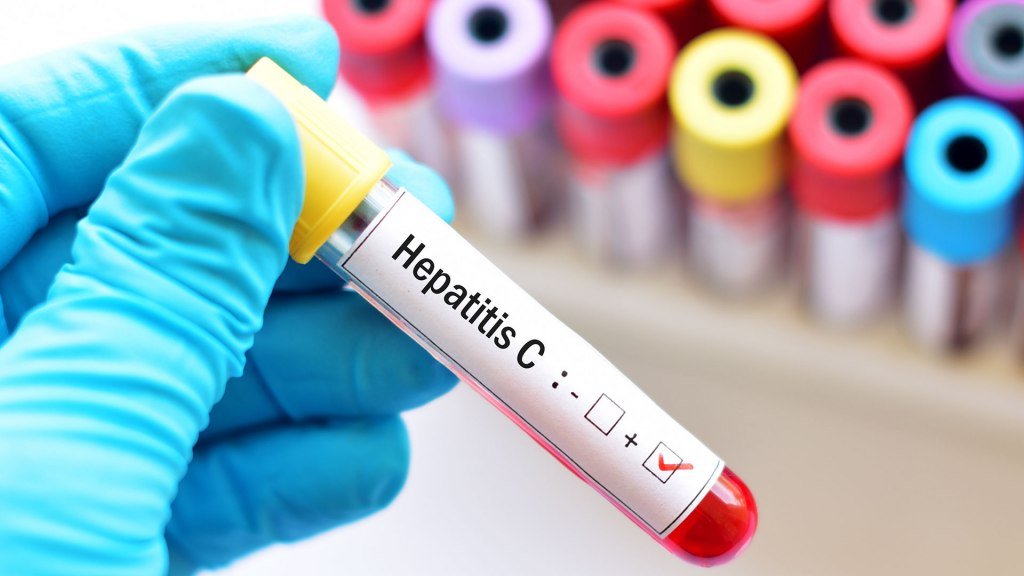 Ocho de cada 10 personas con hepatitis C aún no se trataron para curarse Hepatitis 1