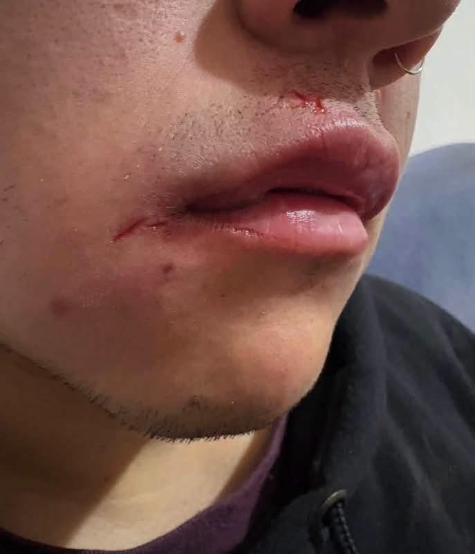 Joven denuncia haber sido agredido por un personal de seguridad de un boliche IMG 3490