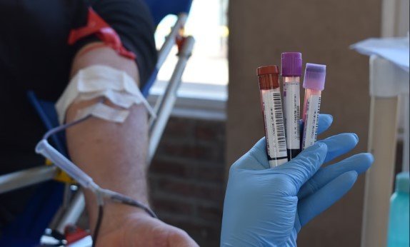 Argentina alcanzó la autosuficiencia en la tipificación de donantes de médula ósea donar sangre 6ab28d6e0b5f9